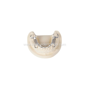 Dental Cast Partial Framework